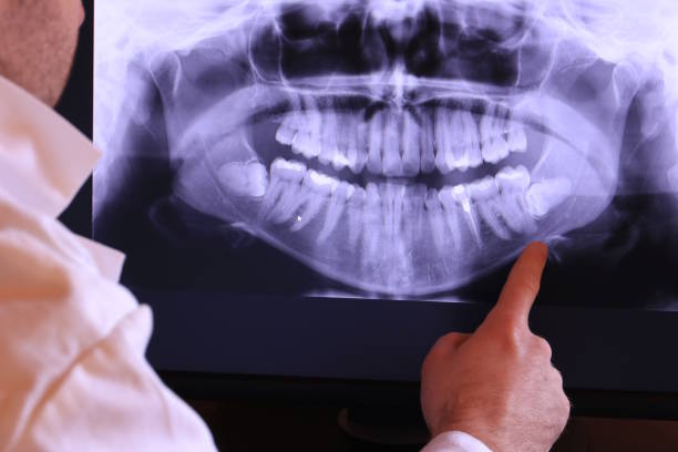 Best Chipped Tooth Repair Near Me  in Waretown, NJ