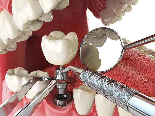 Best Knocked-Out Tooth Emergency  in Waretown, NJ
